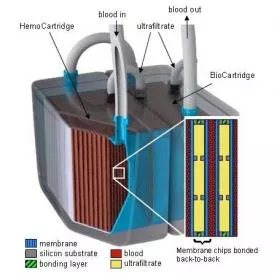 Artificial Kidney Diagram